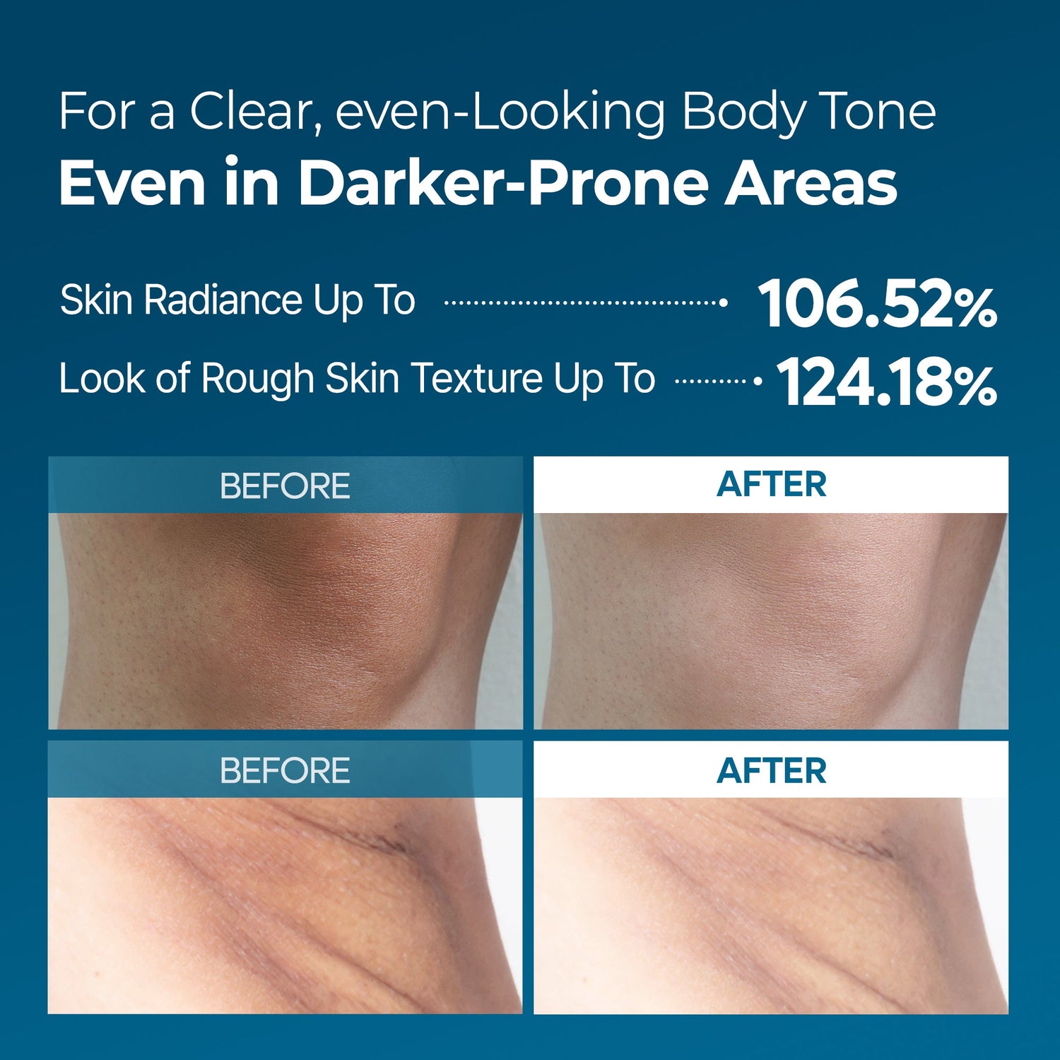 Peel Shot Exfoliating TX Spray