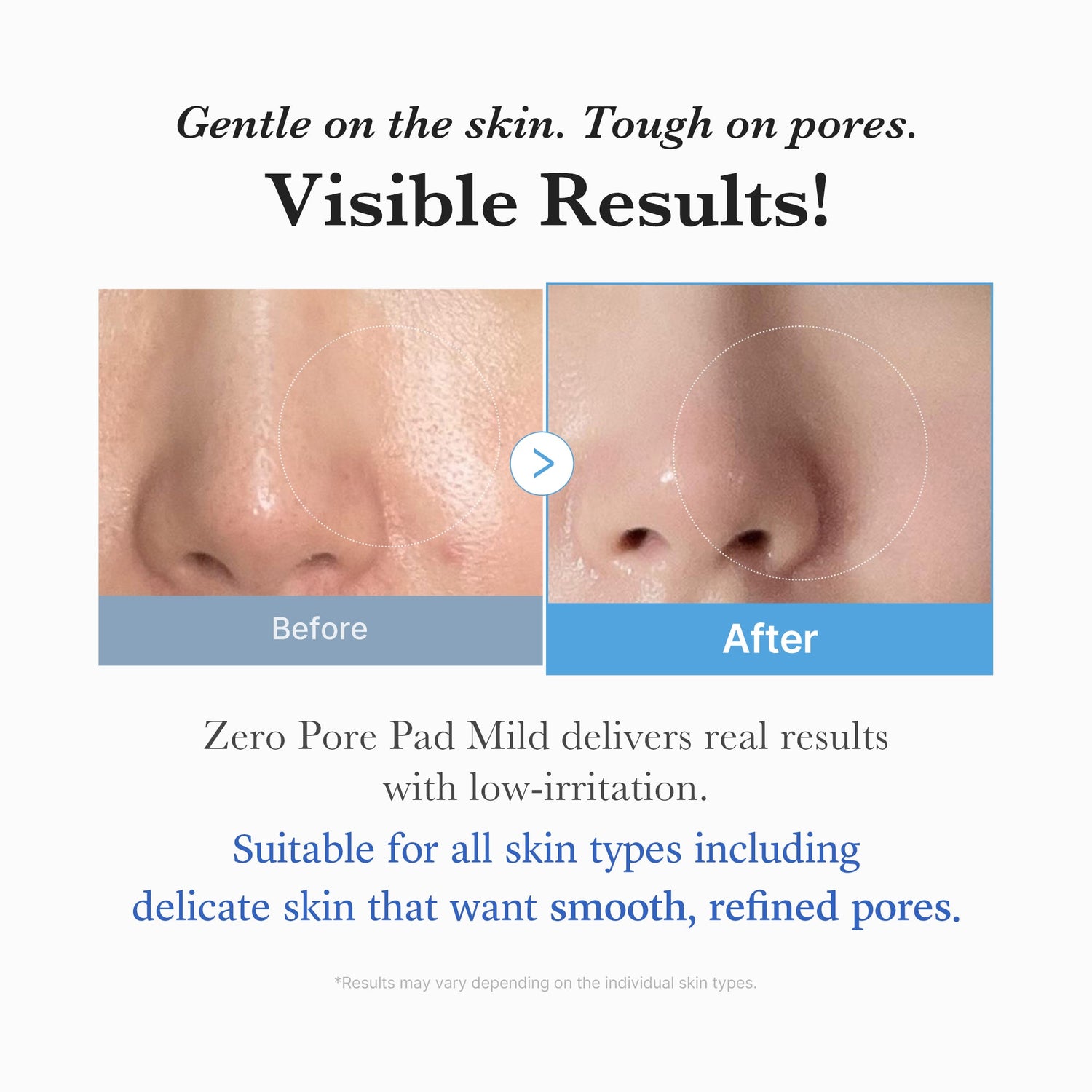 Medicube Zero Pore Madecassoside Pads (Mild)